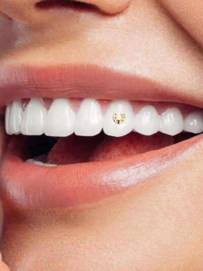 Tooth Gems